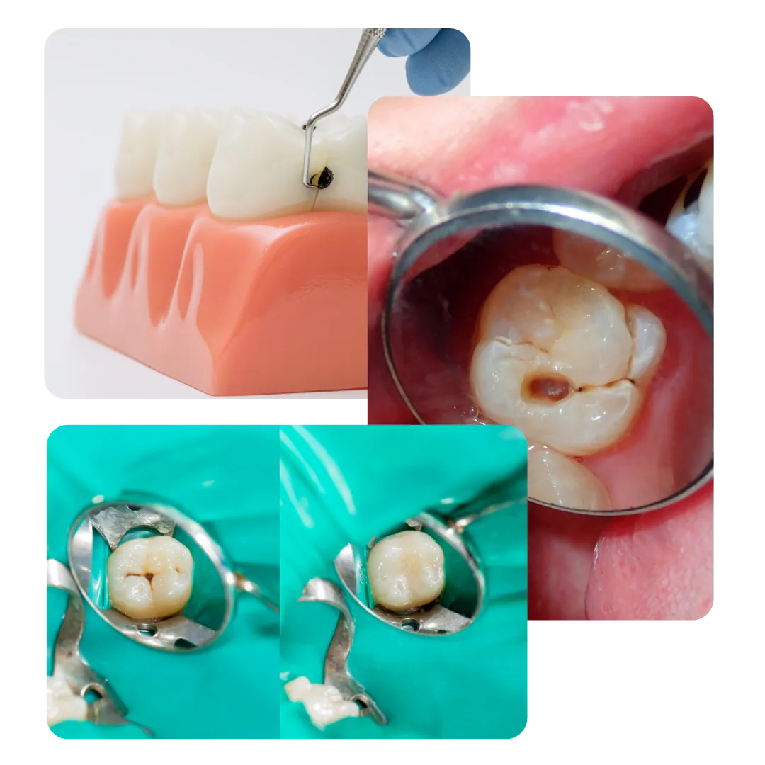 Imágenes del tratamiento dental