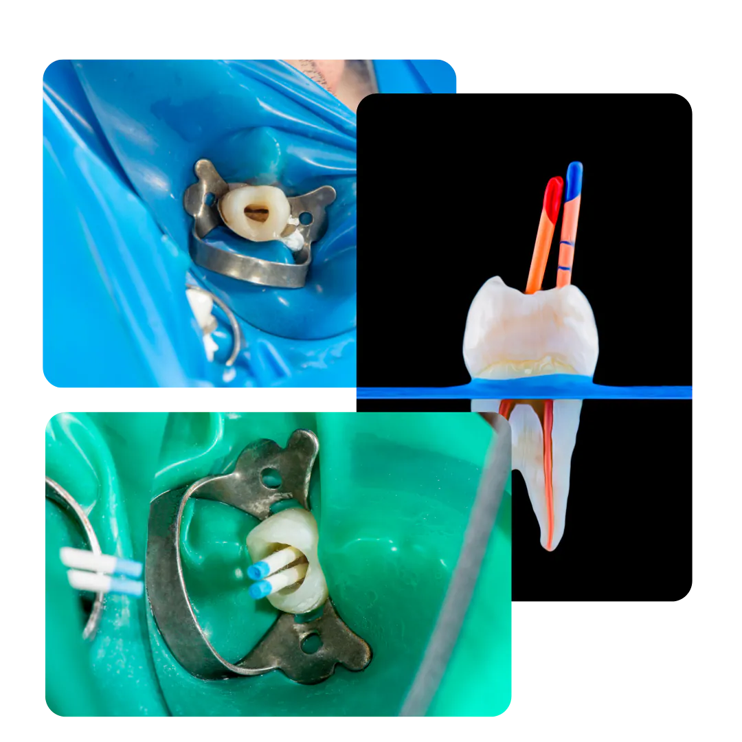 Imágenes del tratamiento dental