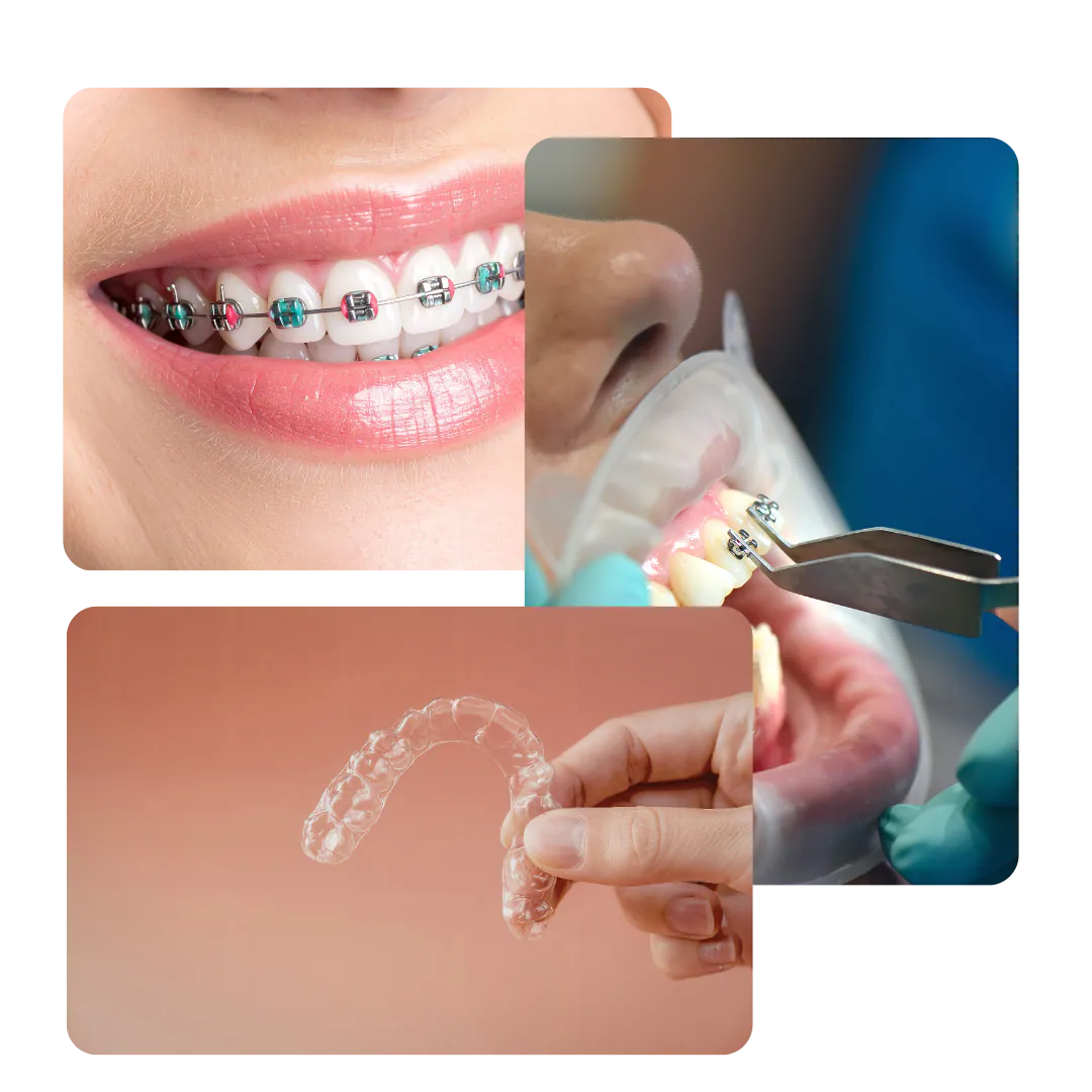 Imágenes del tratamiento dental