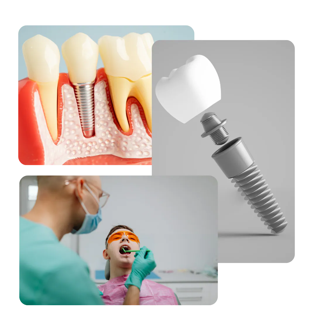 Imágenes del tratamiento dental