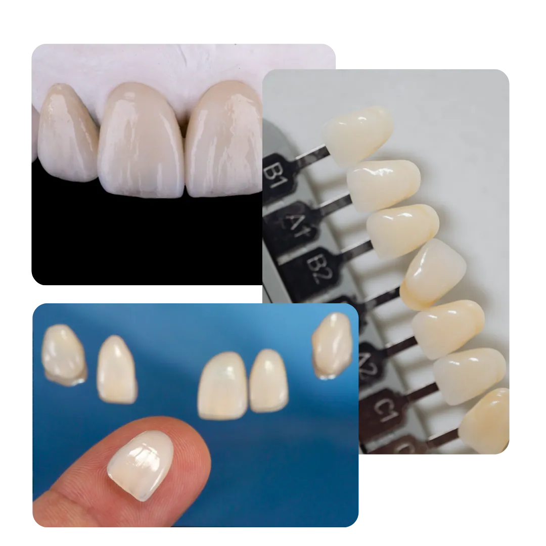 Imágenes del tratamiento dental