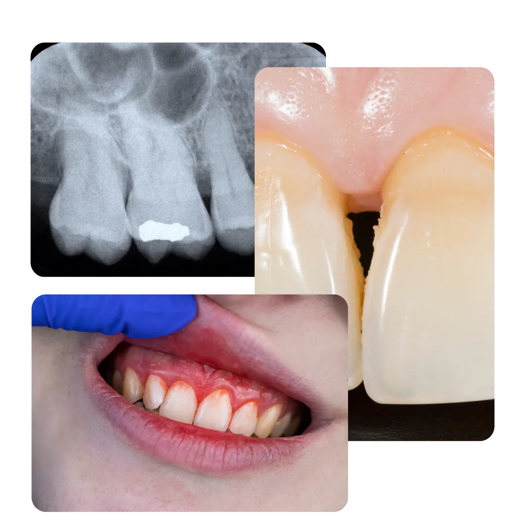 Imágenes del tratamiento dental