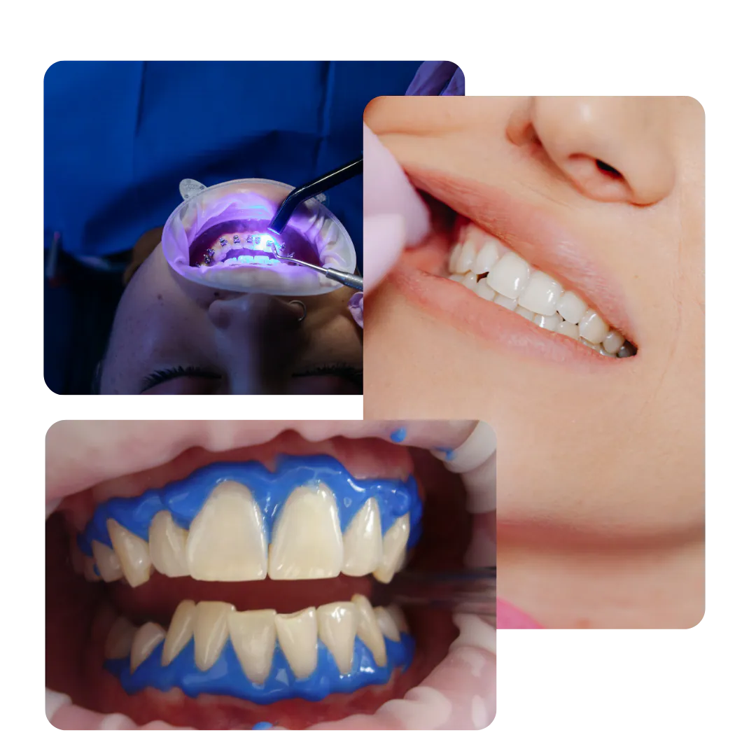 Imágenes del tratamiento dental